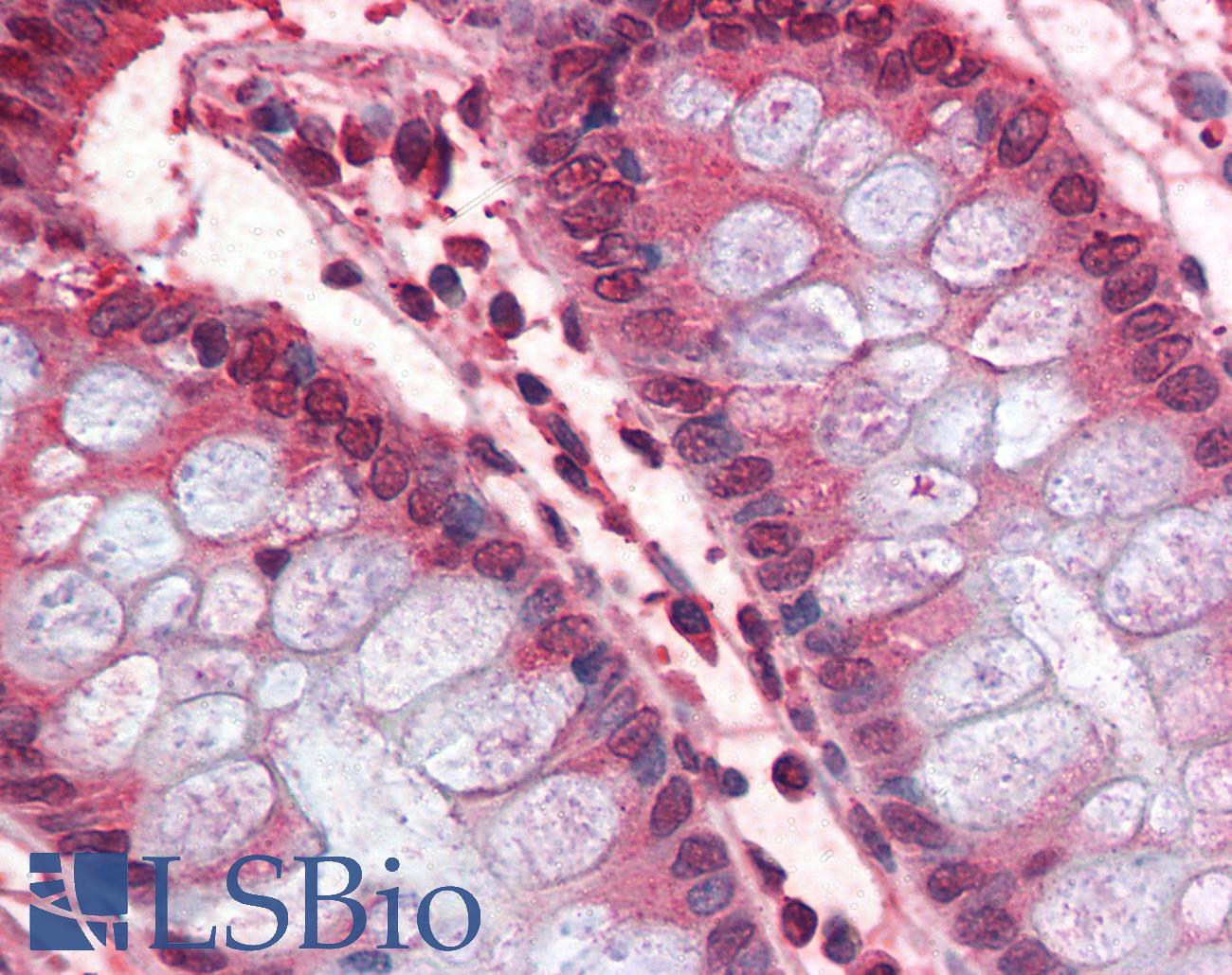 GAPDH Antibody - Anti-GAPDH antibody IHC of human colon. Immunohistochemistry of formalin-fixed, paraffin-embedded tissue after heat-induced antigen retrieval. Antibody dilution 1:100.