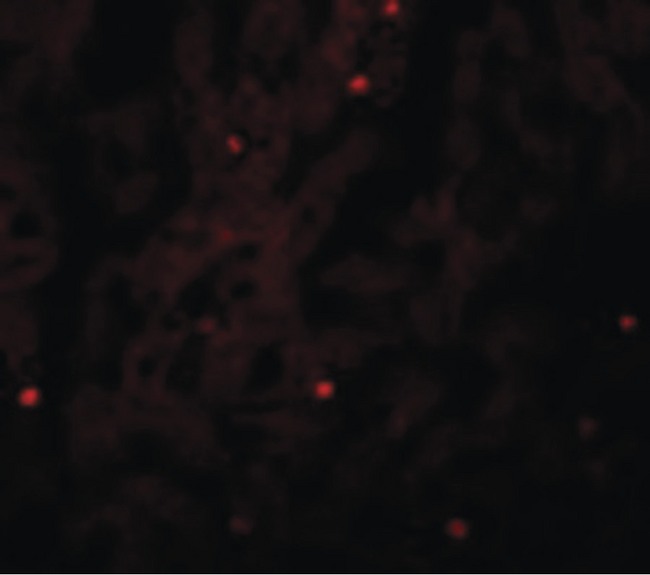 GAREM / FAM59A Antibody - Immunofluorescence of FAM59A in Human Liver cells with FAM59A antibody at 20 ug/ml.