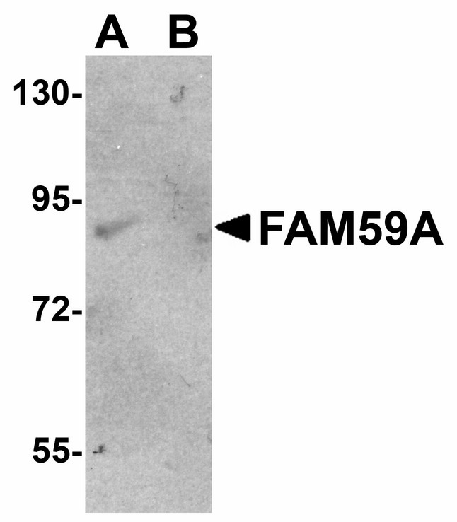 GAREM / FAM59A Antibody - Western blot of FAM59A in rat liver tissue lysate with FAM59A antibody at 1 ug/ml. Lane A is in the absence and lane B in the presence of blocking peptide.