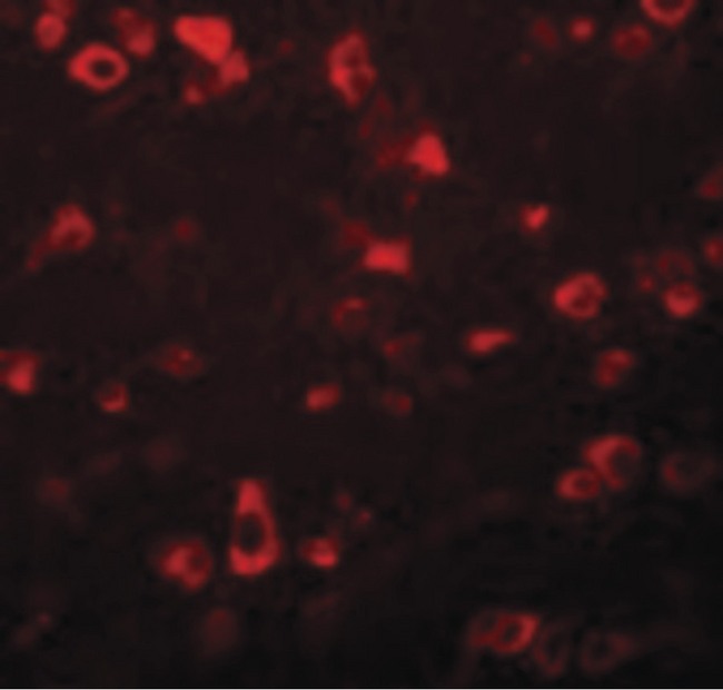 GAREML Antibody - Immunofluorescence of FAM59B in Human Brain cells with FAM59B antibody at 20 ug/ml.
