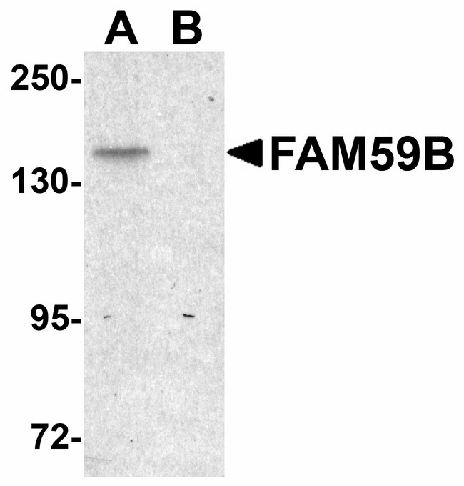 GAREML Antibody - Western blot of FAM59B in SK-N-SH cell lysate with FAM59B antibody at 1 ug/ml in (A) the absence and (B) the presence of blocking peptide. 
