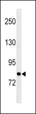 GARS / Glycyl tRNA Synthetase Antibody - Western blot of anti-GARS Antibody in NCI-H460 cell line lysates (35 ug/lane). GARS (arrow) was detected using the purified antibody.