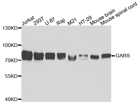GARS / Glycyl tRNA Synthetase Antibody - Western blot analysis of extracts of various cells.