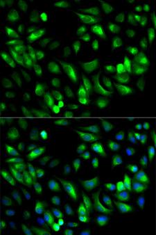 GARS / Glycyl tRNA Synthetase Antibody - Immunofluorescence analysis of MCF-7 cells.