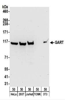 GART / GARS Antibody - Detection of Human and Mouse GART by Western Blot. Samples: Whole cell lysate (50 ug) from HeLa, 293T, Jurkat, mouse TCMK-1, and mouse NIH3T3 cells. Antibodies: Affinity purified rabbit anti-GART antibody used for WB at 0.1 ug/ml. Detection: Chemiluminescence with an exposure time of 30 seconds.