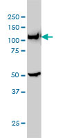 GART / GARS Antibody - GART monoclonal antibody clone 4D6-1D5 Western blot of GART expression in HeLa NE.