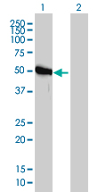 GART / GARS Antibody - Western blot of GART expression in transfected 293T cell line by GART monoclonal antibody clone 4D6-1D5.