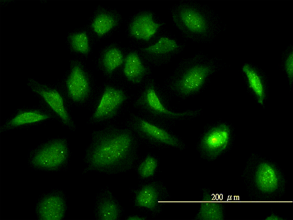 GART / GARS Antibody - Immunofluorescence of monoclonal antibody to GART on HeLa cell (antibody concentration 10 ug/ml).