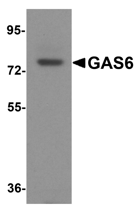 GAS6 Antibody - Western blot analysis of GAS6 in mouse heart tissue lysate with GAS6 antibody at 1 ug/ml.