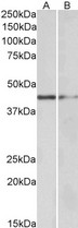 GATA3 Antibody - Goat Anti-GATA3 Antibody (0.5µg/ml) staining of Human Tonsil (A) and Mouse Kidney (B) lysate (35µg protein in RIPA buffer). Primary incubation was 1 hour. Detected by chemiluminescencence