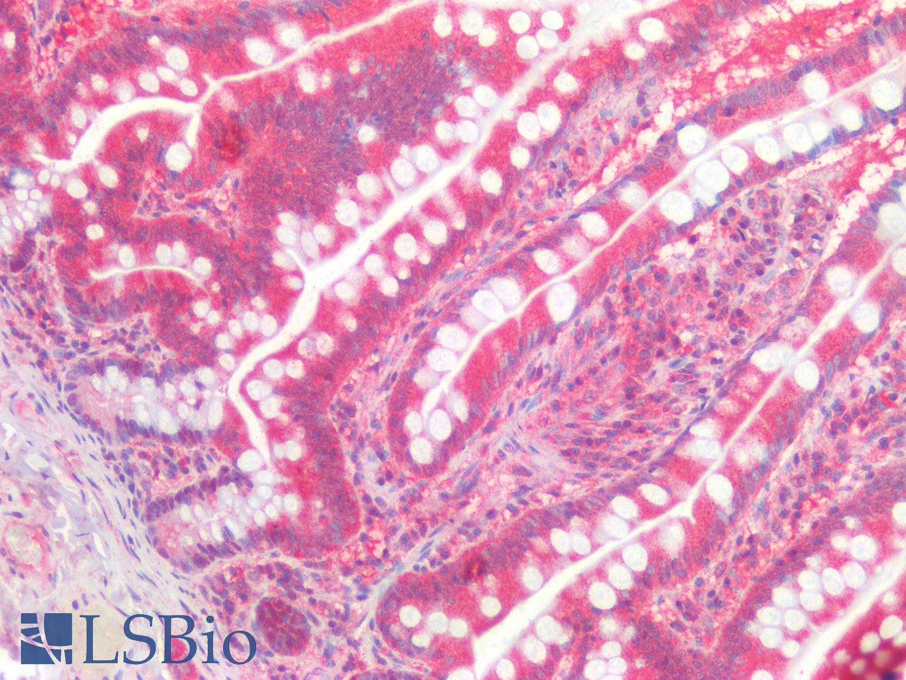 GATA3 Antibody - Human Small Intestine: Formalin-Fixed, Paraffin-Embedded (FFPE)