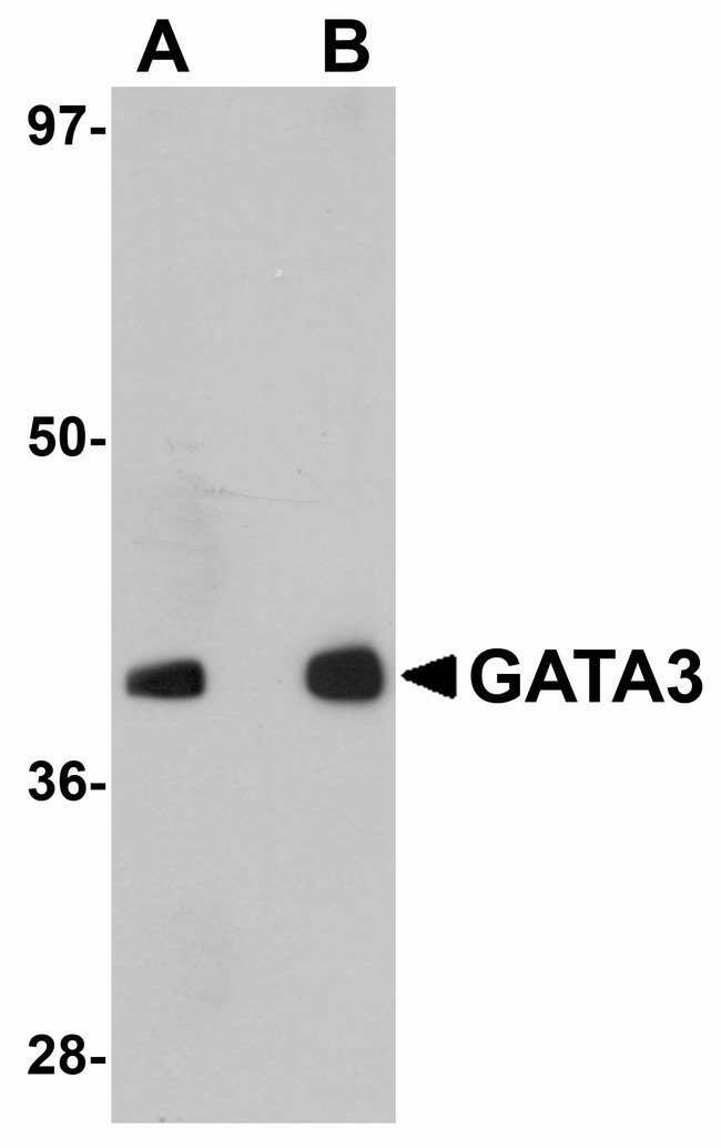 GATA3 Antibody - Western blot of GATA3 in human brain tissue lysate with GATA3 antibody at (A) 1 and (B) 2 ug/ml.