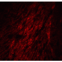 GATA3 Antibody - Immunofluorescence of GATA3 in mouse brain tissue with GATA3 Antibody at 20 µg/mL.