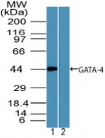 GATA4 Antibody - Western blot of GATA-4 in human kidney lysate in the 1) absence and 2) presence of immunizing peptide using GATA4 Antibody at 2 ug/ml. Goat anti-rabbit Ig HRP secondary antibody, and PicoTect ECL substrate solution, were used for this test.