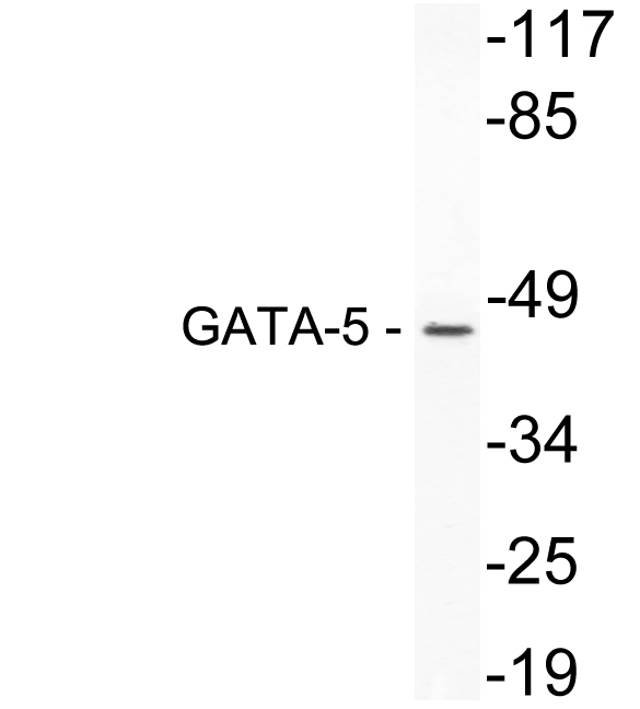 GATA5 Antibody - Western blot of GATA-5 (K293) pAb in extracts from 3T3 cells.