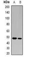 GATM / AGAT Antibody - Western blot analysis of AGAT expression in mouse kidney (A); rat kidney (B) whole cell lysates.