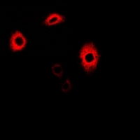 GATM / AGAT Antibody - Immunofluorescent analysis of AGAT staining in A549 cells. Formalin-fixed cells were permeabilized with 0.1% Triton X-100 in TBS for 5-10 minutes and blocked with 3% BSA-PBS for 30 minutes at room temperature. Cells were probed with the primary antibody in 3% BSA-PBS and incubated overnight at 4 deg C in a humidified chamber. Cells were washed with PBST and incubated with a DyLight 594-conjugated secondary antibody (red) in PBS at room temperature in the dark.