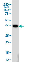 GAX / MEOX2 Antibody - MEOX2 monoclonal antibody clone 6A5 Western blot of MEOX2 expression in HeLa.