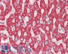 GBA / Glucosidase Beta Acid Antibody - Human Liver: Formalin-Fixed, Paraffin-Embedded (FFPE).  This image was taken for the unconjugated form of this product. Other forms have not been tested.
