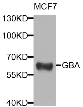 GBA / Glucosidase Beta Acid Antibody - Western blot blot of extracts of MCF7 cells, using GBA antibody.