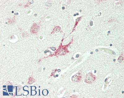 GBA / Glucosidase Beta Acid Antibody - Human Brain, Cortex: Formalin-Fixed, Paraffin-Embedded (FFPE)