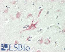 GBA / Glucosidase Beta Acid Antibody - Human Brain, Cortex: Formalin-Fixed, Paraffin-Embedded (FFPE)
