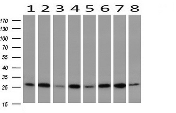 GBAS Antibody - Western blot of extracts (10ug) from 8 Human tissue by using anti-GBAS monoclonal antibody at 1:200 (1: Testis; 2: Uterus; 3: Breast; 4: Brain; 5: Liver; 6: Ovary; 7: Thyroid gland; 8: Colon).