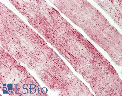 GBAS Antibody - Human Skeletal Muscle: Formalin-Fixed, Paraffin-Embedded (FFPE)