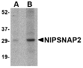 GBAS Antibody - Western blot of NIPSNAP2 in human skeletal muscle tissue lysate with NIPSNAP2 antibody at (A) 1 and (B) 2 ug/ml.
