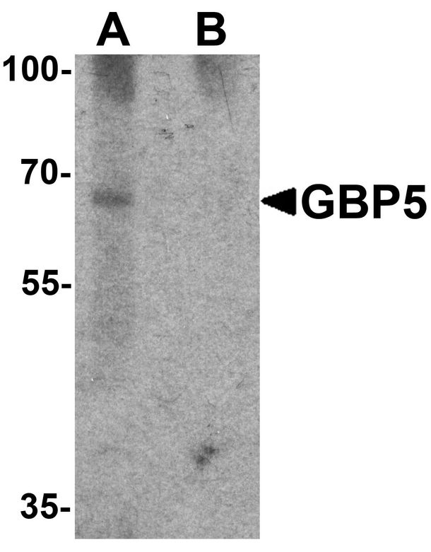 GBP5 Antibody - Western blot analysis of GBP5 in rat liver tissue lysate with GBP5 antibody at 1 ug/ml in (A) the absence and (B) the presence of blocking peptide.
