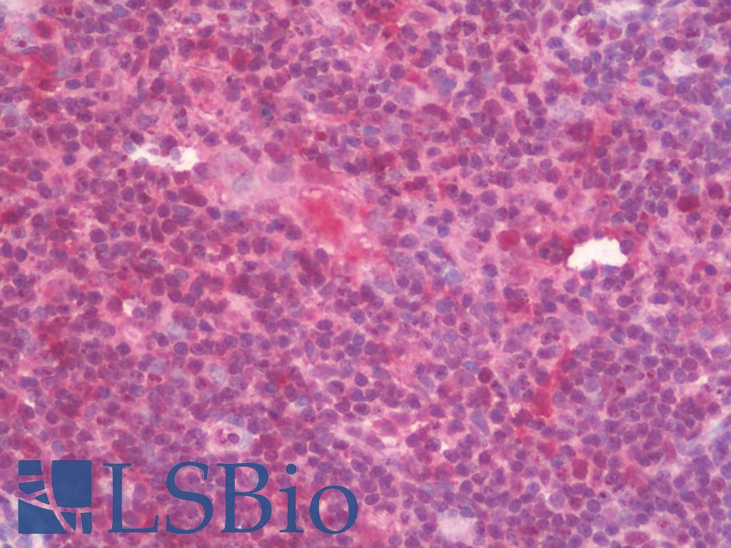 GBP5 Antibody - Anti-GBP5 antibody IHC staining of human thymus. Immunohistochemistry of formalin-fixed, paraffin-embedded tissue after heat-induced antigen retrieval. Antibody concentration 10 ug/ml.