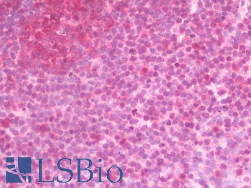 GBP5 Antibody - Anti-GBP5 antibody IHC staining of human tonsil. Immunohistochemistry of formalin-fixed, paraffin-embedded tissue after heat-induced antigen retrieval.