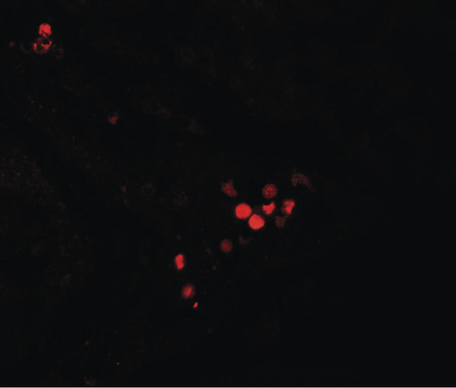 GBP5 Antibody - Immunofluorescence of GBP5 in human liver tissue with GBP5 antibody at 20 ug/ml.