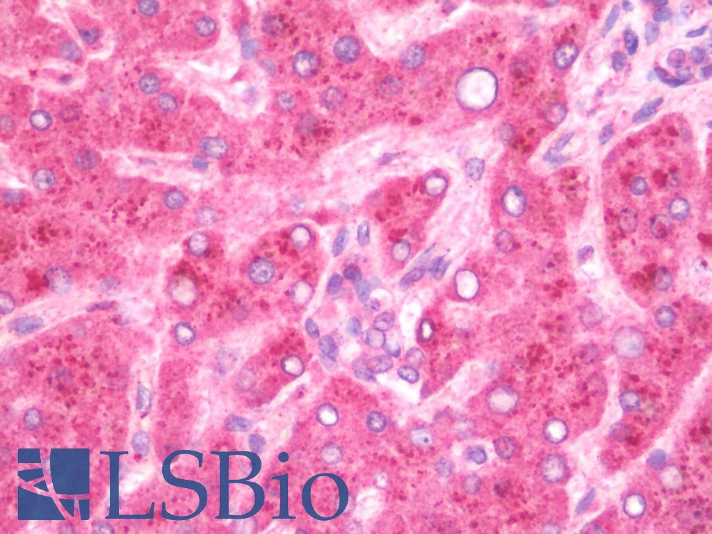 GBP5 Antibody - Anti-GBP5 antibody IHC staining of human liver. Immunohistochemistry of formalin-fixed, paraffin-embedded tissue after heat-induced antigen retrieval. Antibody concentration 5 ug/ml.