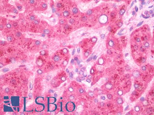GBP5 Antibody - Anti-GBP5 antibody IHC staining of human liver. Immunohistochemistry of formalin-fixed, paraffin-embedded tissue after heat-induced antigen retrieval. Antibody concentration 5 ug/ml.