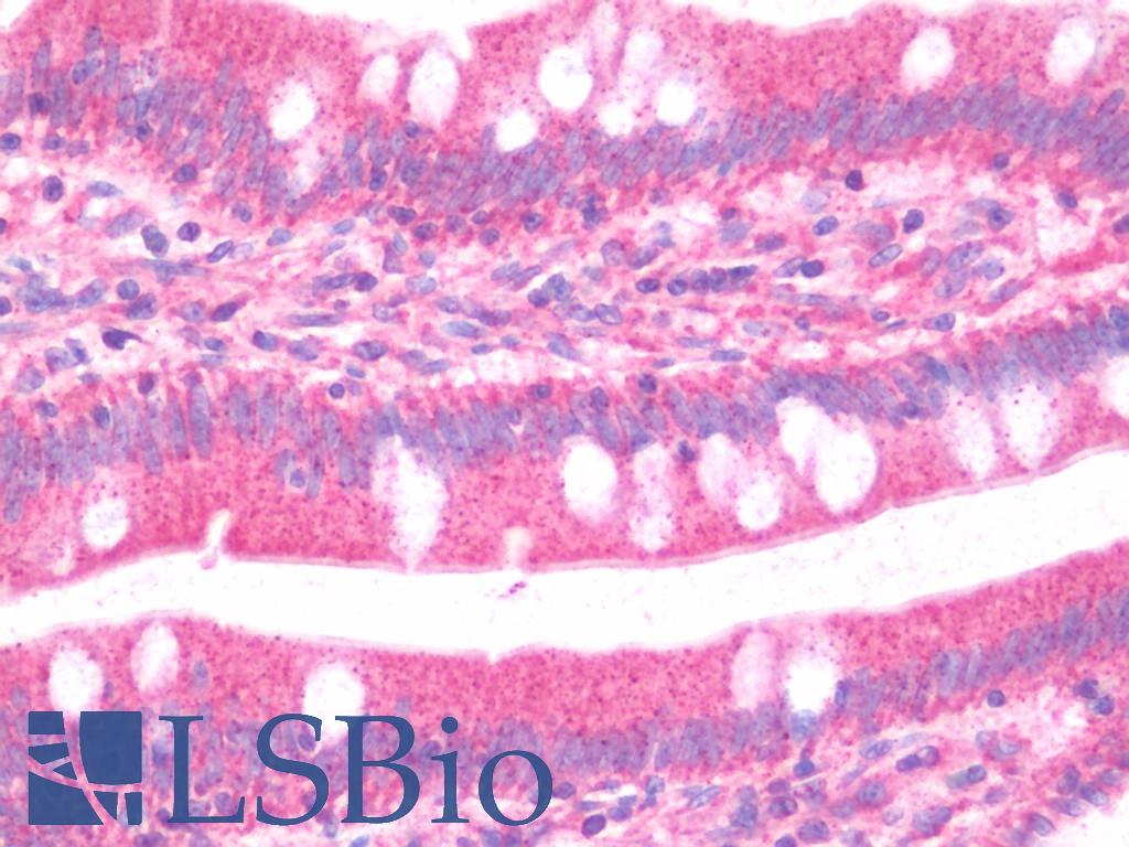 GBP5 Antibody - Anti-GBP5 antibody IHC staining of human small intestine. Immunohistochemistry of formalin-fixed, paraffin-embedded tissue after heat-induced antigen retrieval.