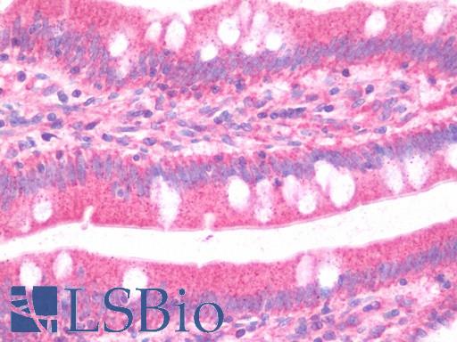 GBP5 Antibody - Anti-GBP5 antibody IHC staining of human small intestine. Immunohistochemistry of formalin-fixed, paraffin-embedded tissue after heat-induced antigen retrieval.