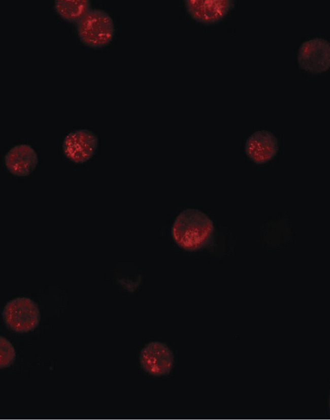 GBP6 Antibody - Immunofluorescence of GBP6 in HeLa cells with GBP6 antibody at 5 ug/ml.