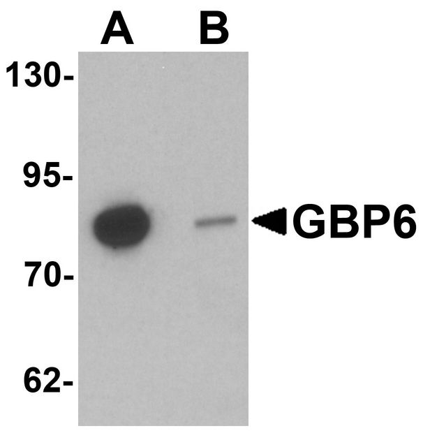 GBP6 Antibody - Western blot analysis of GBP6 in HeLa cell lysate with GBP6 antibody at 0.5 ug/ml in (A) the absence and (B) the presence of blocking peptide.