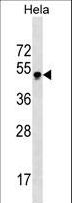 GBX2 Antibody - GBX2 Antibody western blot of HeLa cell line lysates (35 ug/lane). The GBX2 antibody detected the GBX2 protein (arrow).