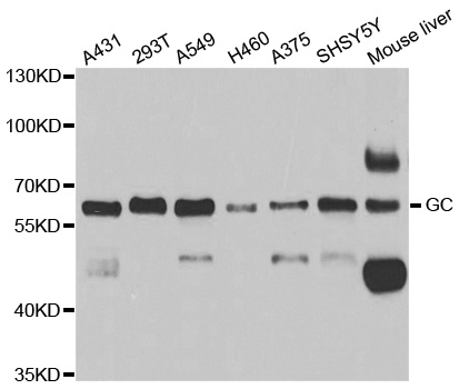 GC / Vitamin D-Binding Protein Antibody - Western blot analysis of extracts of various cell lines, using GC antibody.