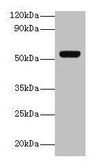GC / Vitamin D-Binding Protein Antibody - Western blot All lanes: Vitamin D-binding protein antibody at 2µg/ml + A549 whole cell lysate Secondary Goat polyclonal to rabbit IgG at 1/10000 dilution Predicted band size: 53, 40, 56 kDa Observed band size: 53 kDa