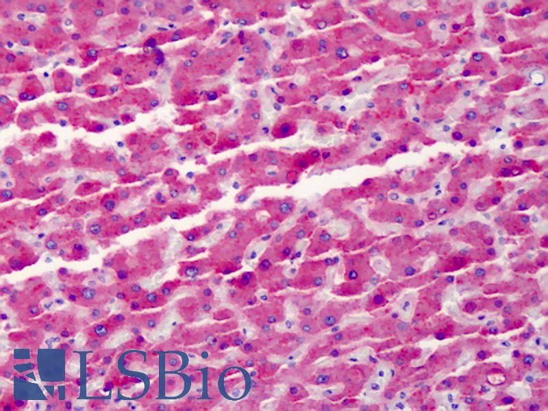GC / Vitamin D-Binding Protein Antibody - Anti-GC / VDBP antibody IHC of human liver. Immunohistochemistry of formalin-fixed, paraffin-embedded tissue after heat-induced antigen retrieval. Antibody concentration 5 ug/ml.