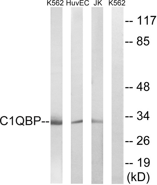 GC1qR / C1QBP Antibody - Western blot analysis of lysates from Jurkat, HUVEC, and K562 cells, using C1QBP Antibody. The lane on the right is blocked with the synthesized peptide.