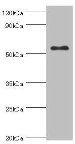 GCK / Glucokinase Antibody - Western blot All lanes: Glucokinase antibody at 8µg/ml + HepG2 whole cell lysate Secondary Goat polyclonal to rabbit IgG at 1/10000 dilution Predicted band size: 52 kDa Observed band size: 52 kDa