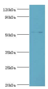 GCK / Glucokinase Antibody - Western blot. All lanes: Glucokinase antibody at 8 ug/ml+Jurkat whole cell lysate. Secondary antibody: Goat polyclonal to rabbit at 1:10000 dilution. Predicted band size: 52 kDa. Observed band size: 52 kDa Immunohistochemistry.