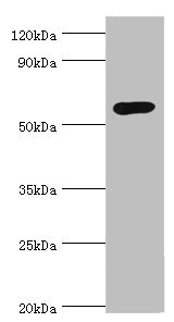GCK / Glucokinase Antibody - Western blot All lanes: Glucokinase antibody at 8µg/ml + Jurkat whole cell lysate Secondary Goat polyclonal to rabbit IgG at 1/10000 dilution Predicted band size: 52 kDa Observed band size: 52 kDa