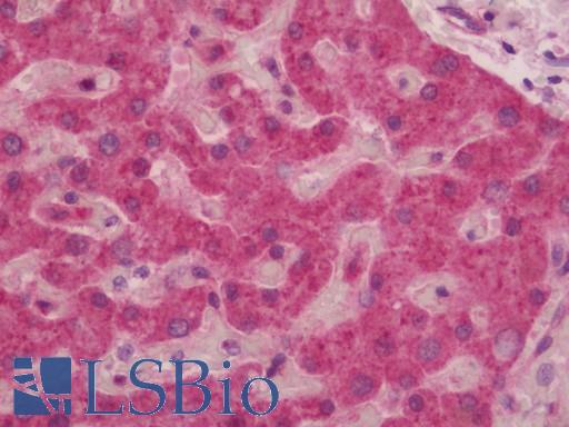 GCLC Antibody - Human Liver: Formalin-Fixed, Paraffin-Embedded (FFPE)
