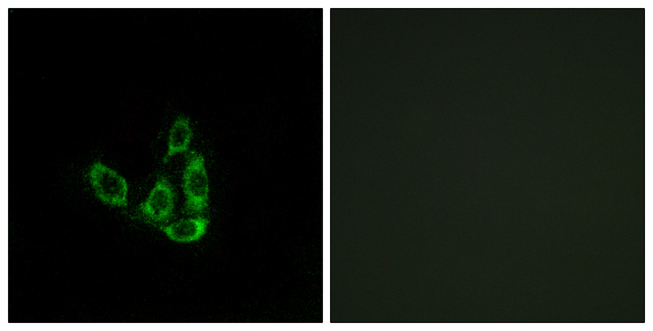 GCNT3 Antibody - Immunofluorescence analysis of A549 cells, using GCNT3 Antibody. The picture on the right is blocked with the synthesized peptide.