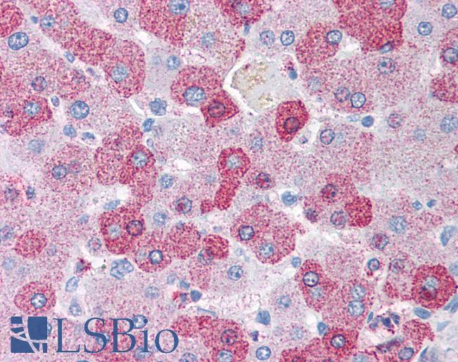 GCNT3 Antibody - Anti-GCNT3 antibody IHC of human liver. Immunohistochemistry of formalin-fixed, paraffin-embedded tissue after heat-induced antigen retrieval.
